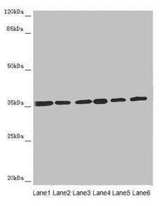 Western blot All lanes: ETFA antibody at 4.34µg/ml Lane 1: A431 whole cell lysate Lane 2: Hela whole cell lysate Lane 3: K562 whole cell lysate Lane 4: A549 whole cell lysate Lane 5: HepG2 whole cell lysate Lane 6: MCF-7 whole cell lysate Secondar...