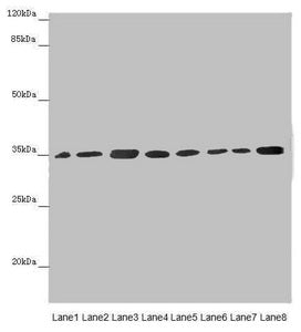 Western blot All lanes: ETFA antibody at 2.88µg/ml Lane 1: Mouse small intestine tissue Lane 2: Mouse liver tissue Lane 3: A431 whole cell lysate Lane 4: Hela whole cell lysate Lane 5: K562 whole cell lysate Lane 6: A549 whole cell lysate Lane 7:...