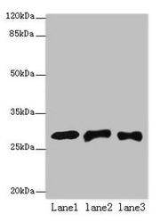 Western blot All lanes: ETHE1 antibody at 8µg/ml Lane 1: Mouse liver tissue Lane 2: HepG2 whole cell lysate Lane 3: Hela whole cell lysate Secondary Goat polyclonal to rabbit IgG at 1/10000 dilution Predicted band size: 28 kDa Observed band size:...