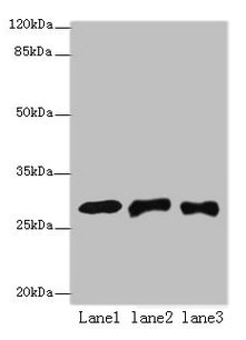 Western blot All lanes: ETHE1 antibody at 8µg/ml Lane 1: Mouse liver tissue Lane 2: HepG2 whole cell lysate Lane 3: Hela whole cell lysate Secondary Goat polyclonal to rabbit IgG at 1/10000 dilution Predicted band size: 28 kDa Observed band size:...