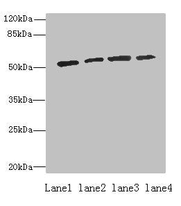 Western blot All lanes: ETNK1 antibody at 0.5µg/ml Lane 1: A549 whole cell lysate Lane 2: A431 whole cell lysate Lane 3: HepG2 whole cell lysate Lane 4: MCF-7 whole cell lysate Secondary Goat polyclonal to rabbit IgG at 1/10000 dilution Predicted...