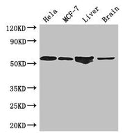 Western Blot Positive WB detected in: Hela whole cell lysate, MCF-7 whole cell lysate, Mouse liver tissue, Mouse brain tissue All lanes: ETS2 antibody at 2.7µg/ml Secondary Goat polyclonal to rabbit IgG at 1/50000 dilution Predicted band size: 54...