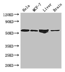 Western Blot Positive WB detected in: Hela whole cell lysate, MCF-7 whole cell lysate, Mouse liver tissue, Mouse brain tissue All lanes: ETS2 antibody at 2.7µg/ml Secondary Goat polyclonal to rabbit IgG at 1/50000 dilution Predicted band size: 54...