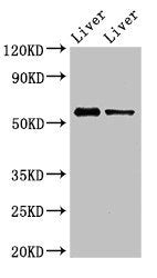 Western Blot Positive WB detected in: Mouse liver tissue, Rat liver tissue All lanes: ETV1 antibody at 3ug/ml Secondary Goat polyclonal to rabbit IgG at 1/50000 dilution Predicted band size: 56, 54, 53, 44, 49, 51 kDa Observed band size: 56 kDa