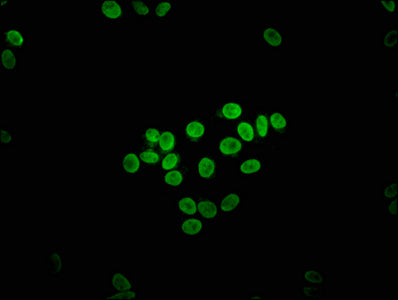 Immunofluorescence staining of HepG2 cells with CSB-PA007855LA01HU at 1:133, counter-stained with DAPI. The cells were fixed in 4% formaldehyde, permeabilized using 0.2% Triton X-100 and blocked in 10% normal Goat Serum. The cells were then incuba...