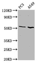 Western Blot Positive WB detected in: PC-3 whole cell lysate, A549 whole cell lysate All lanes: ETV5 antibody at 4.6µg/ml Secondary Goat polyclonal to rabbit IgG at 1/50000 dilution Predicted band size: 58, 63 kDa Observed band size: 58 kDa