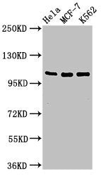 Western Blot Positive WB detected in: Hela whole cell lysate, MCF-7 whole cell lysate, K562 whole cell lysate All lanes: EVC antibody at 2ug/ml Secondary Goat polyclonal to rabbit IgG at 1/50000 dilution Predicted band size: 112 kDa Observed band...