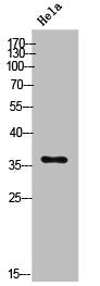 Western Blot analysis of HeLa cells using E2F-5 Polyclonal Antibody