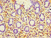 Immunohistochemistry of paraffin-embedded human small intestine tissue using CSB-PA007875ESR2HU at dilution of 1:100