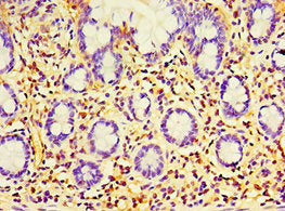 Immunohistochemistry of paraffin-embedded human small intestine tissue using CSB-PA007875ESR2HU at dilution of 1:100