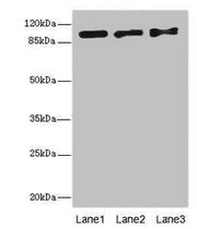 Western blot All lanes: EXO1 antibody at 10ug/ml Lane 1: Hela whole cell lysate Lane 2: 293T whole cell lysate Lane 3: A549 whole cell lysate Secondary Goat polyclonal to rabbit IgG at 1/10000 dilution Predicted band size: 95, 90 kDa Observed band...