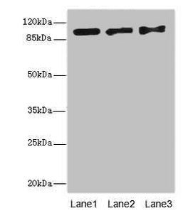 Western blot All lanes: EXO1 antibody at 10ug/ml Lane 1: Hela whole cell lysate Lane 2: 293T whole cell lysate Lane 3: A549 whole cell lysate Secondary Goat polyclonal to rabbit IgG at 1/10000 dilution Predicted band size: 95, 90 kDa Observed band...