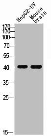 Western blot analysis of HEPG2-UV MOUSE-BRAIN using p-EDG-1 (T236) antibody.