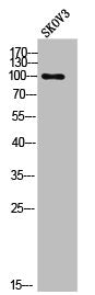 Western Blot analysis of SKOV3 cells using Phospho-EF-2 (T56) Polyclonal Antibody