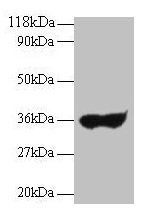 Western blot All lanes: Human IgG light chain antibody at 2µg/ml + Human serum at 1: 100 Secondary Goat polyclonal to rabbit IgG at 1/10000 dilution Predicted band size: 35 kDa Observed band size: 35 kDa