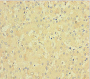 Immunohistochemistry of paraffin-embedded human liver tissue using CSB-PA007916LA01HU at dilution of 1:100