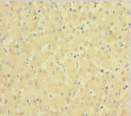 Immunohistochemistry of paraffin-embedded human liver tissue using CSB-PA007916LA01HU at dilution of 1:100