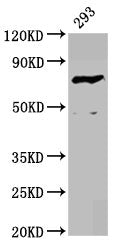 Western Blot Positive WB detected in: 293 whole cell lysate All lanes: F13B antibody at 4.17µg/ml Secondary Goat polyclonal to rabbit IgG at 1/50000 dilution Predicted band size: 76 kDa Observed band size: 76 kDa