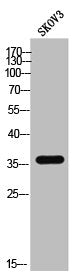 Western Blot analysis of SKOV3 cells using Ephrin-B3 Polyclonal Antibody