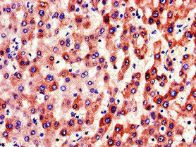 Immunohistochemistry of paraffin-embedded human liver tissue using CSB-PA007936LA01HU at dilution of 1:100