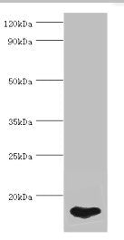 Western blot All lanes: FABP5 antibody at 5ug/ml + HepG2 whole cell lysate Secondary Goat polyclonal to rabbit IgG at 1/10000 dilution Predicted band size: 15 kDa Observed band size: 15 kDa
