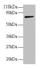 Western blot All lanes: ANXA6 antibody at 2µg/ml + Rat liver tissue Secondary Goat polyclonal to rabbit IgG at 1/10000 dilution Predicted band size: 76, 73 kDa Observed band size: 76 kDa