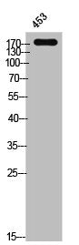 Western Blot analysis of 453 cells using Phospho-EGFR (Y1172) Polyclonal Antibody