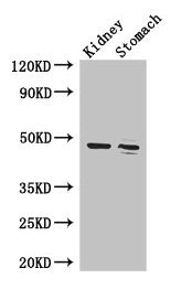 Western Blot Positive WB detected in: Mouse kidney tissue, Mouse stomach tissue All lanes: FAH antibody at 3.4µg/ml Secondary Goat polyclonal to rabbit IgG at 1/50000 dilution Predicted band size: 47, 39 kDa Observed band size: 47 kDa