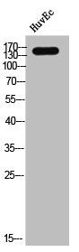 Western Blot analysis of HUVEC cells using EGFR Polyclonal Antibody