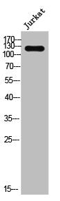 Western Blot analysis of Jurkat cells using A Cyclase IV Polyclonal Antibody