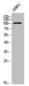 Western Blot analysis of 22RV1 cells using EphA2 Polyclonal Antibody
