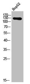 Western Blot analysis of HepG2 cells using Phospho-EphA2/3/4 (Y588/596) Polyclonal Antibody