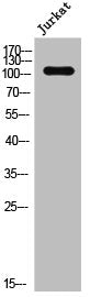 Western Blot analysis of JK cells using Phospho-EphA2/5 (Y594) Polyclonal Antibody