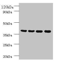 Western blot All lanes: Prootein FAM110B antibody at 2ug/ml Lane 1: Mouse sexual gland tissue Lane 2: HepG2 whole cell lysate Lane 3: Mouse spleen tissue Lane 4: A431 whole cell lysate Secondary Goat polyclonal to rabbit IgG at 1/10000 dilution Pr...