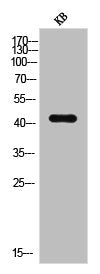 Western Blot analysis of KB cells using Elk-1 Polyclonal Antibody
