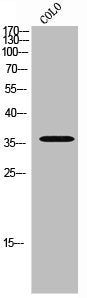Western Blot analysis of COLO cells using Phospho-Net (S357) Polyclonal Antibody