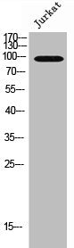 Western Blot analysis of Jurkat cells using EMR1 Polyclonal Antibody