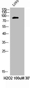 Western Blot analysis of LOVO+H2O2 cells using Phospho-Cortactin (Y421) Polyclonal Antibody