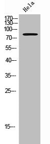 Western Blot analysis of HeLa cells using Cortactin Polyclonal Antibody