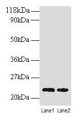 Western blot All lanes: TAGLN antibody at 2µg/ml Lane 1: EC109 whole cell lysate Lane 2: 293T whole cell lysate Secondary Goat polyclonal to rabbit IgG at 1/15000 dilution Predicted band size: 23 kDa Observed band size: 23 kDa