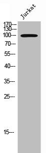 Western Blot analysis of JK cells using EphA3 Polyclonal Antibody