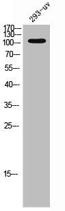 Western Blot analysis of 293T-UV cells using EphA3 Polyclonal Antibody