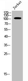 Western Blot analysis of JK cells using Phospho-EphA4 (Y596) Polyclonal Antibody