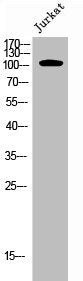 Western Blot analysis of JK cells using Phospho-EphA7 (Y791) Polyclonal Antibody
