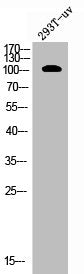 Western Blot analysis of 293T-UV cells using EphA7 Polyclonal Antibody