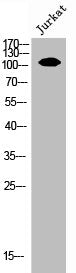 Western Blot analysis of JK cells using EphA7 Polyclonal Antibody