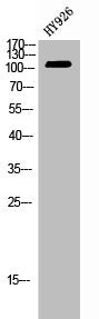 Western Blot analysis of HY926 cells using EphB4 Polyclonal Antibody
