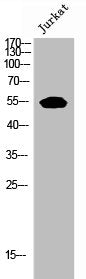 Western Blot analysis of JK cells using EpoR Polyclonal Antibody
