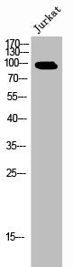 Western Blot analysis of JK cells using Phospho-Eps15 (Y849) Polyclonal Antibody