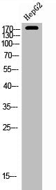 Western Blot analysis of HEPG2 cells using Neu Polyclonal Antibody